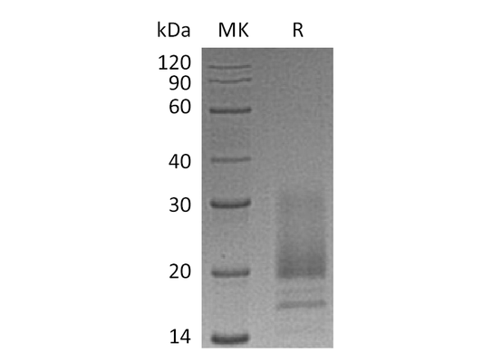 Recombinant Human VIP (C-6His)