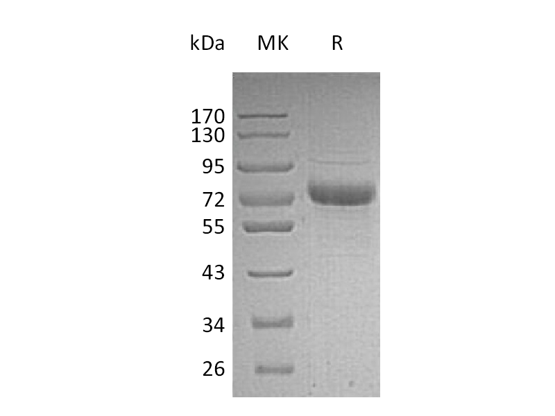 Recombinant Human Vitronectin (C-6His)