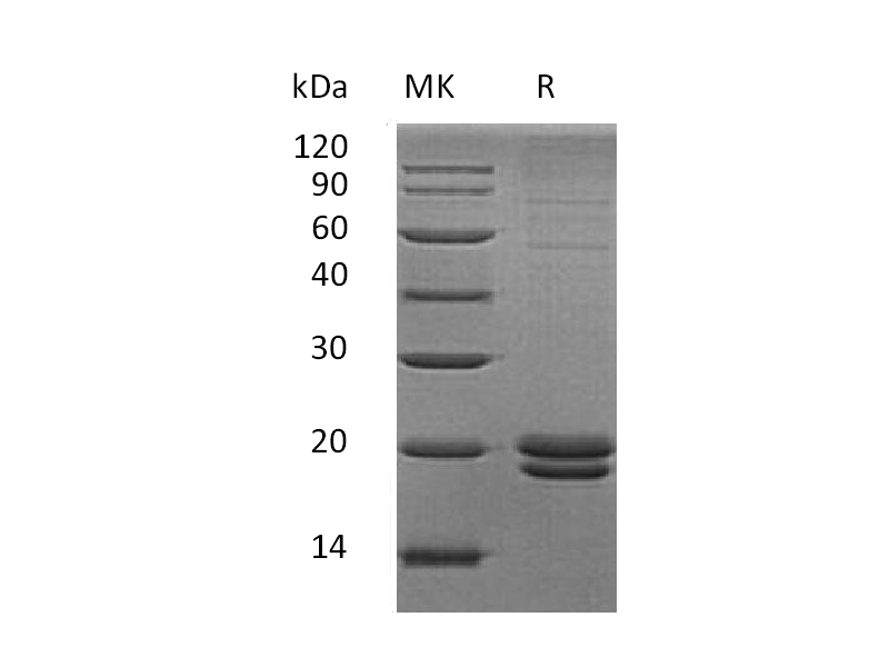Recombinant Human VMO1 (C-6His)