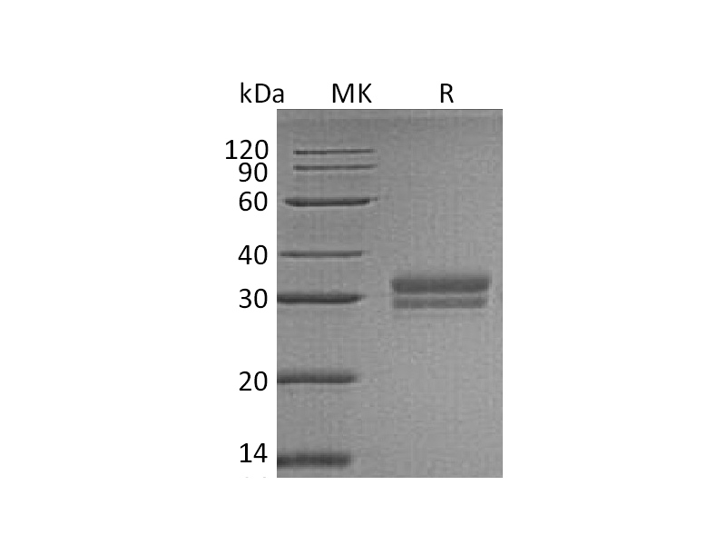 Recombinant Human VSIG2 (C-6His)