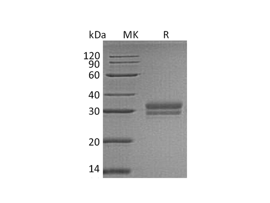 Recombinant Human VSIG2 (C-6His)
