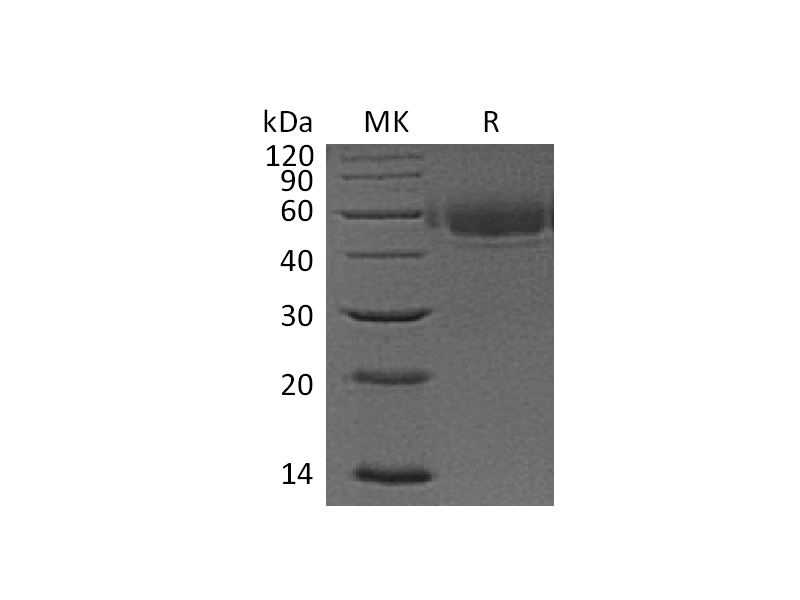 Recombinant Human VSIG4 (C-6His)