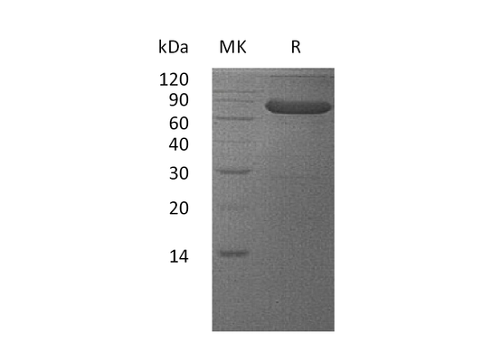 Recombinant Human VSIG4 (C-Fc)