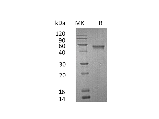 Recombinant Human XCL1 (C-Fc-6His)