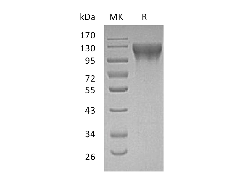 Recombinant Human ECE-1 (N-8His)