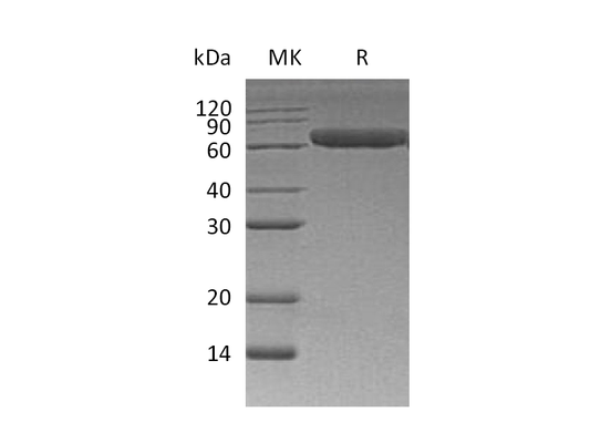 Recombinant Human ROR1 (C-6His)