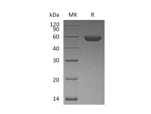 Recombinant Human ROR2 (C-6His)