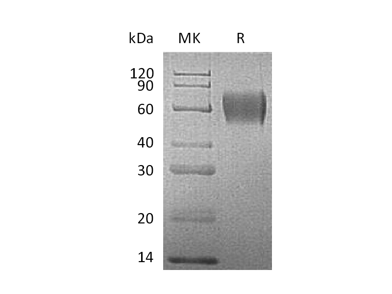 Recombinant Human IL-17RA (C-6His)