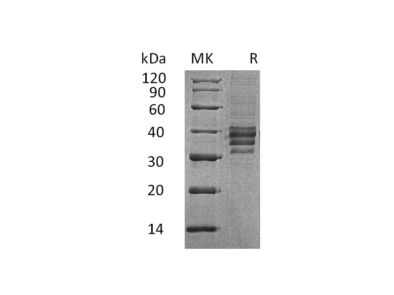 Recombinant Human Follistatin 288 (C-6His)