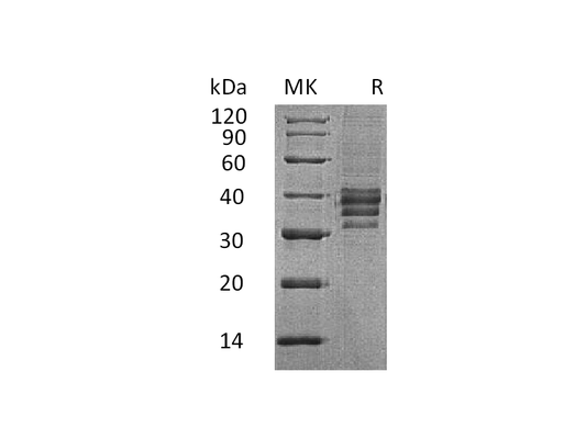 Recombinant Human Follistatin 288 (C-6His)