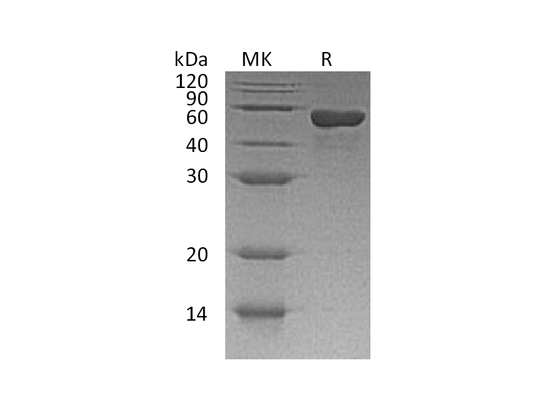 Recombinant Human sCD4 (C-6His)