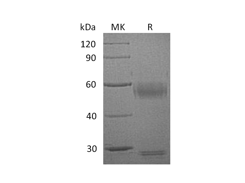 Recombinant Human MMP-8 (C-10His)