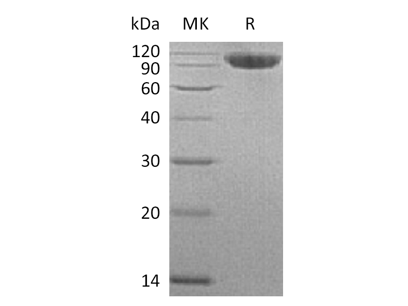 Recombinant Human CFHR4 (C-6His)