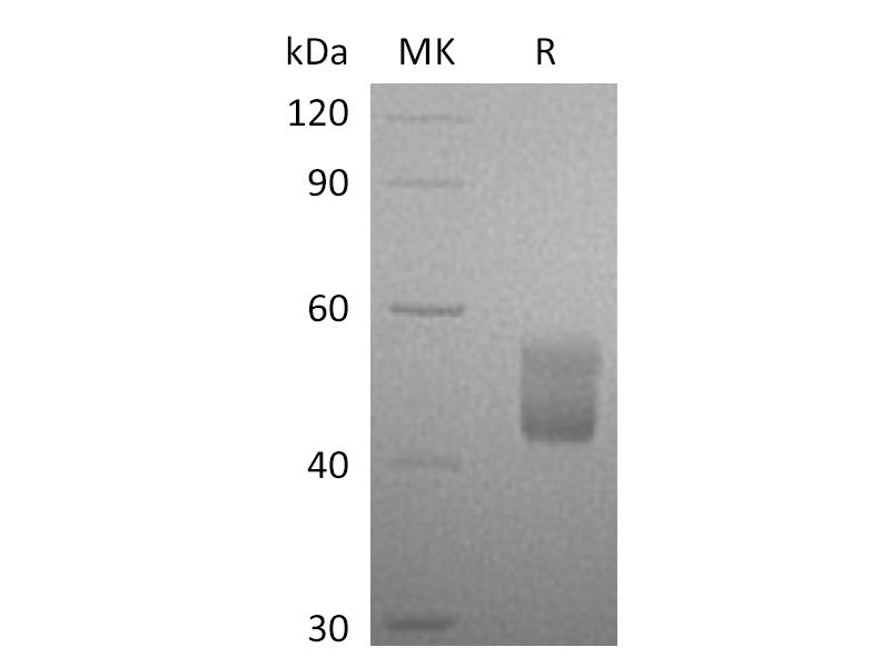 Recombinant Human CFHR3 (C-6His)