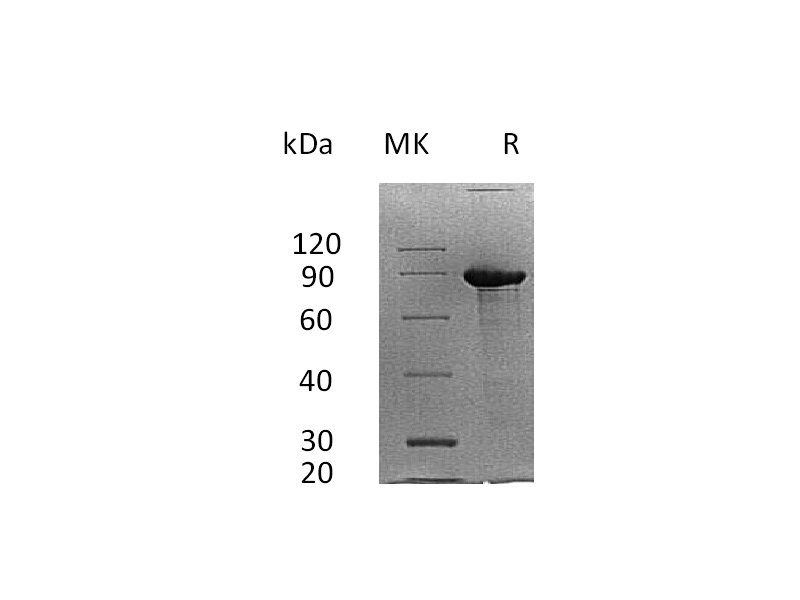 Recombinant Human SDC1 (C-Fc)
