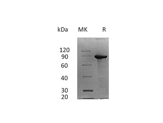 Recombinant Human SDC1 (C-Fc)