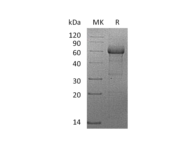 Recombinant Human TNF RII (C-mFc)