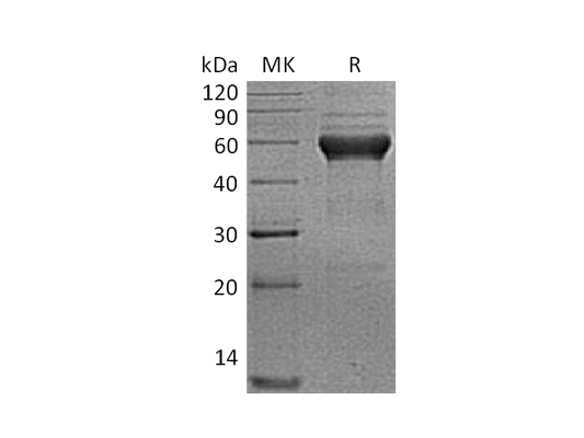 Recombinant Human ALK-1 (C-Fc)