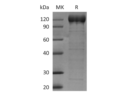 Recombinant Human AOC3 (C-Fc)