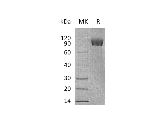 Recombinant Human IL-1RAPL1 (C-Fc)
