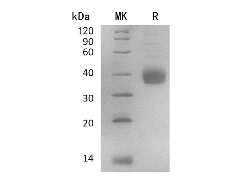 Recombinant Human NACHRA5 (C-6His)