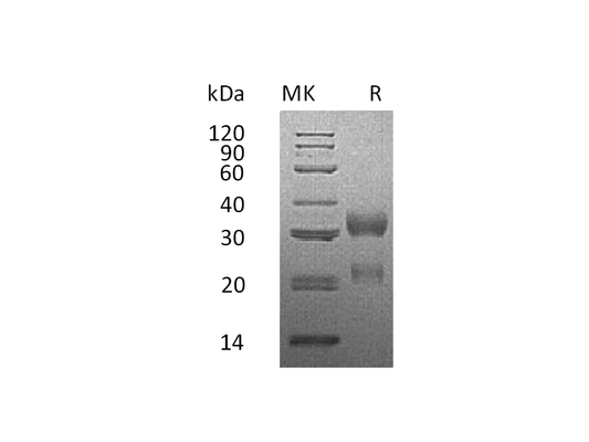 Recombinant Human CGA&CGB3 (C-Flag,C-6His)