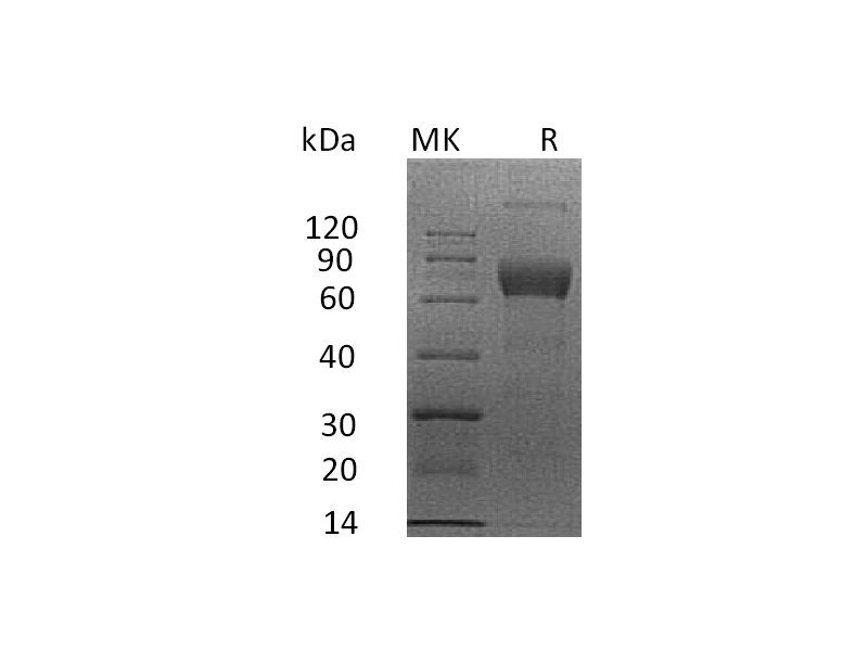 Recombinant Human IL-4 RA (C-mFc)