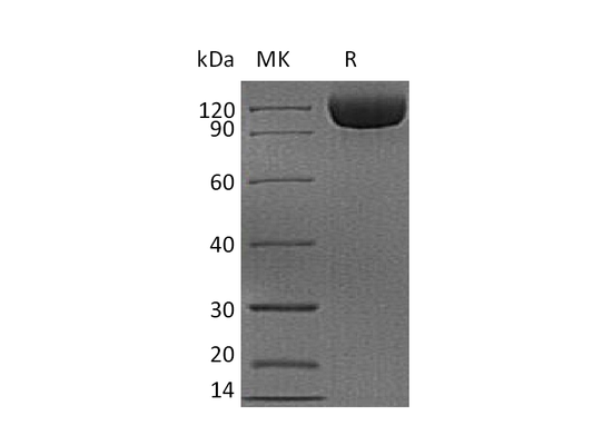 Recombinant Human CD26 (C-6His)