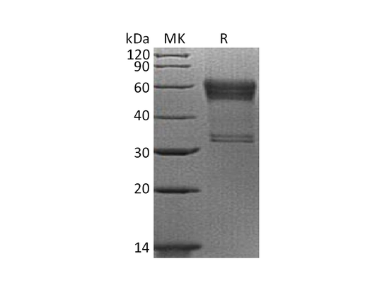 Recombinant Human 4-1BB (C-mFc)