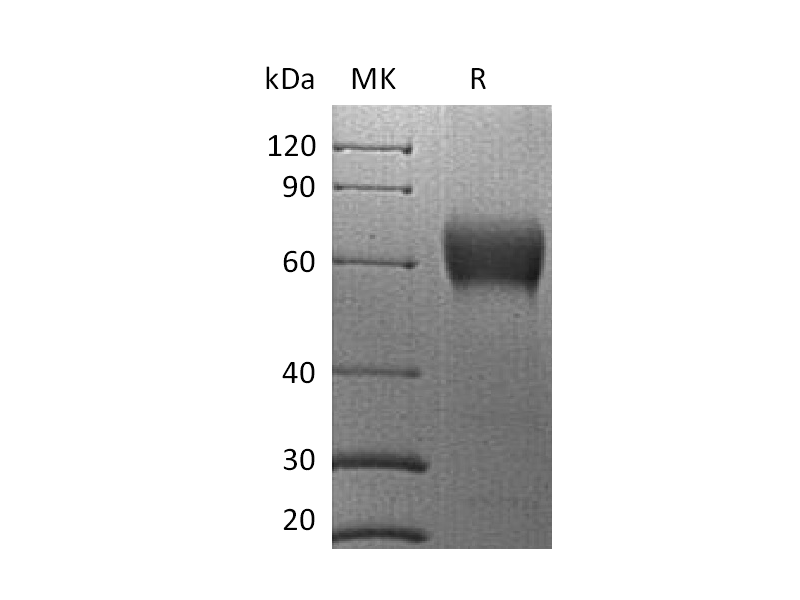 Recombinant Human VISTA (C-mFc)