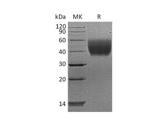 Recombinant Human IL-10RA (C-6His)