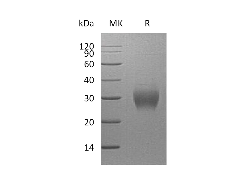 Recombinant Human Asprosin (N-8His)