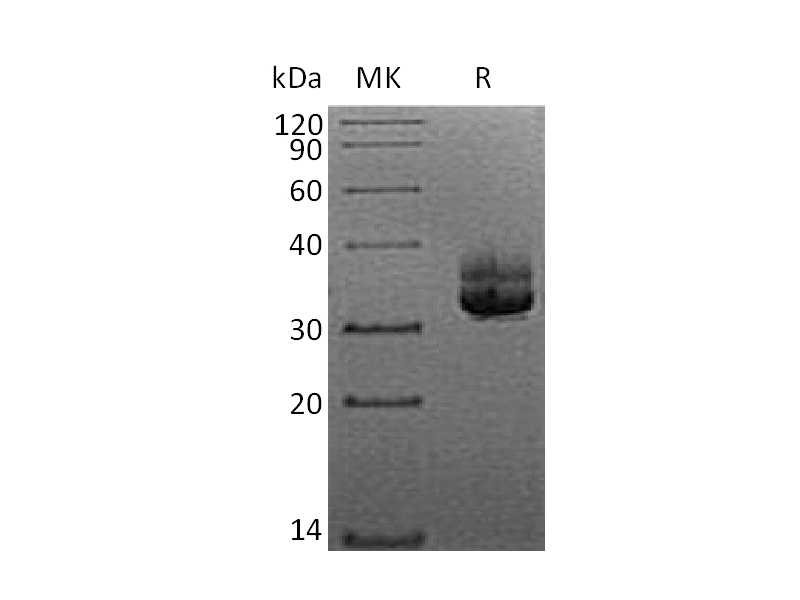 Recombinant Human CD207 (N-6His)