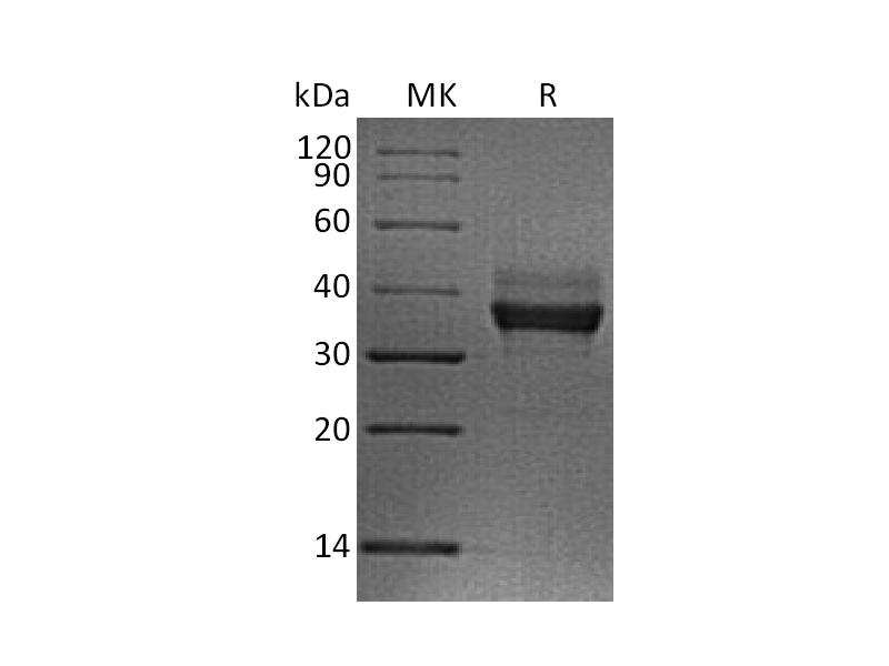 Recombinant Human LILRB4 (C-6His)