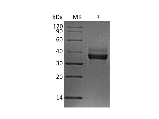 Recombinant Human LILRB4 (C-6His)