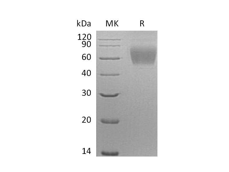 Recombinant Human Siglec-9 (C-6His)