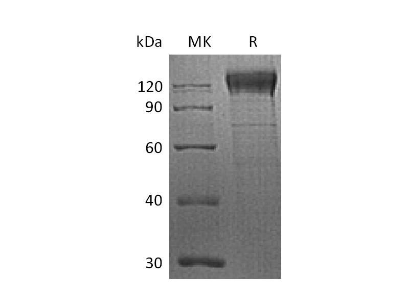 Recombinant Human ITGB1 (C-6His)