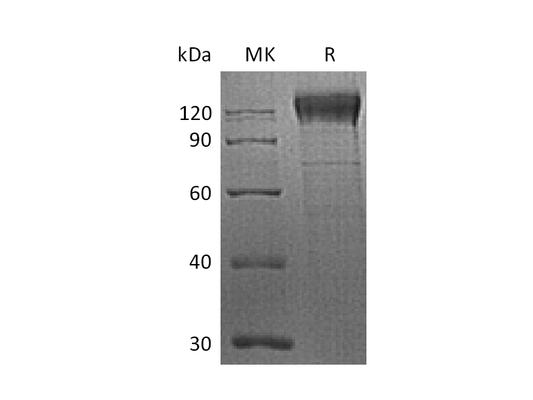 Recombinant Human ITGB1 (C-6His)