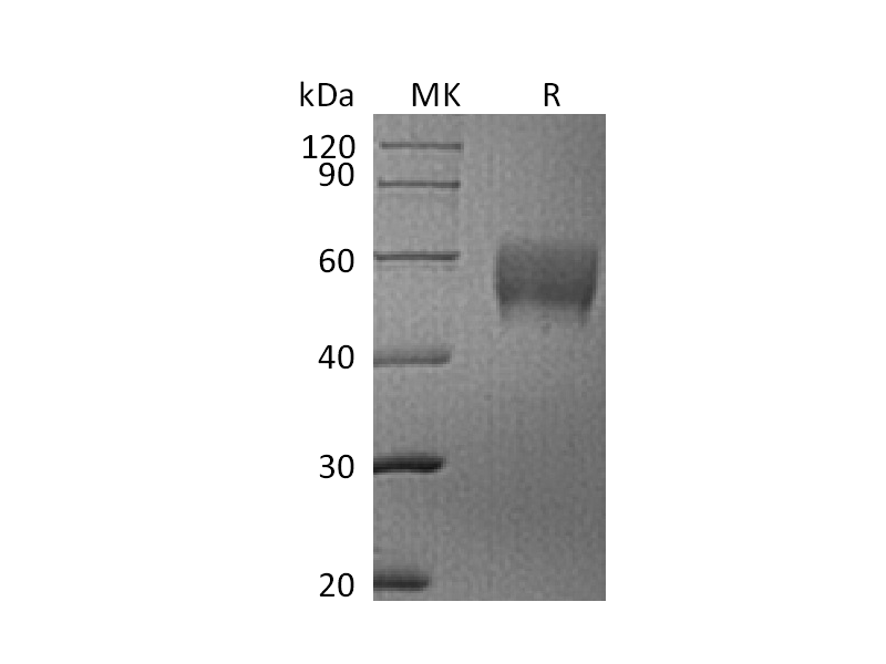 Recombinant Human Siglec-7 (C-6His)
