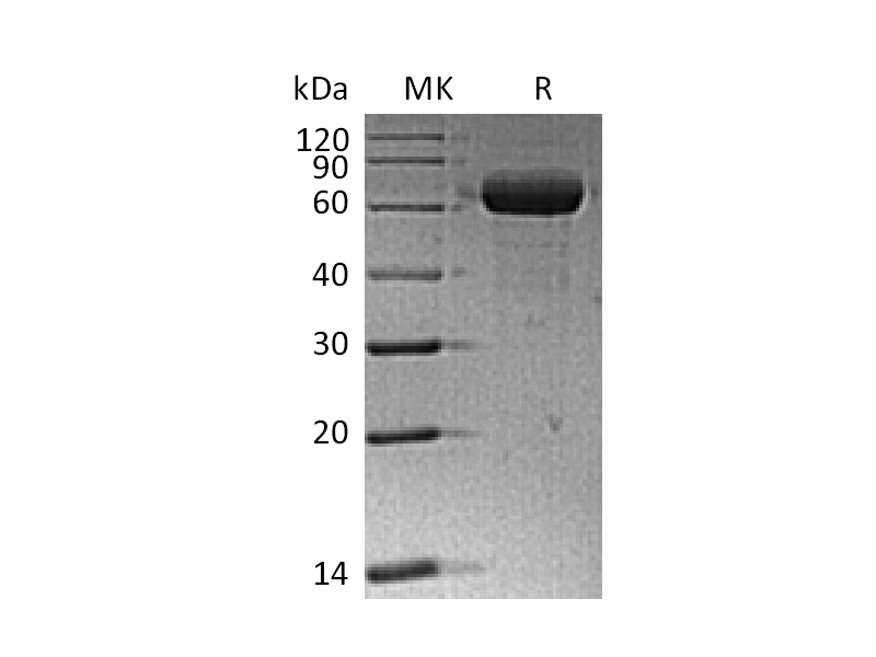 Recombinant Human Siglec-15 (C-Fc)