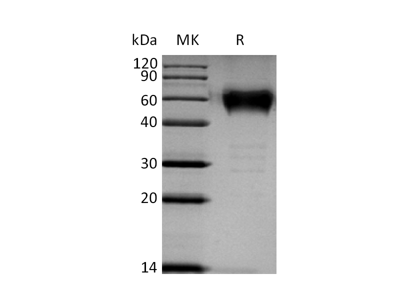 Recombinant Human BTLA (C-mFc)