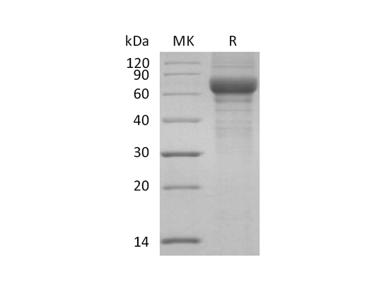Recombinant Human Vitronectin (N-Truncated, C-6His)