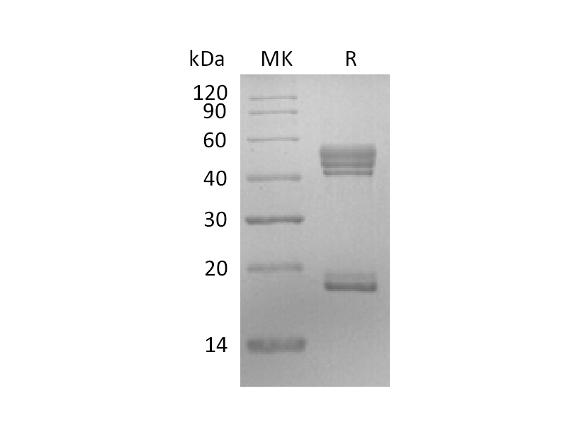Recombinant Human IL-23 (C-6His)