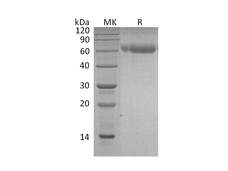 Recombinant Human Serpin A7 (C-6His)