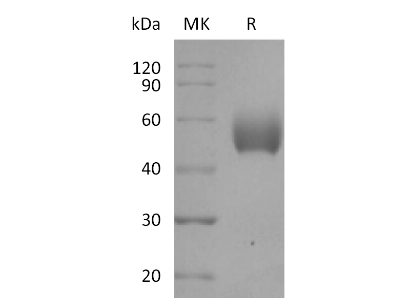 Recombinant Human SIRPA (C-6His)