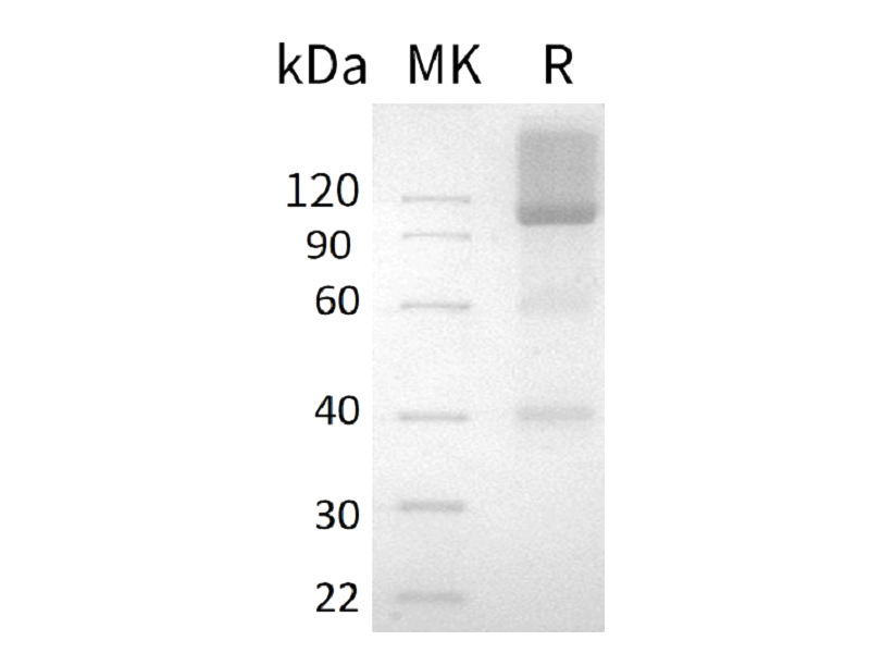 Recombinant Human GPC3 (C-Fc)