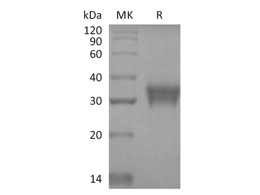Recombinant Human STC-1 (C-6His)