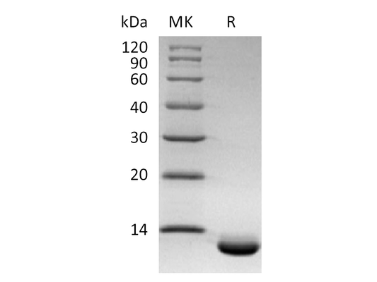 Recombinant Human CXCL6 (C-6His)