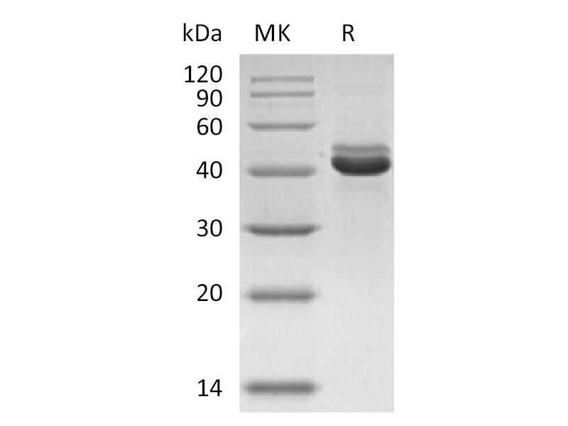 Recombinant Human CD5L (C-6His)
