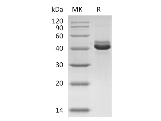 Recombinant Human CD5L (C-6His)